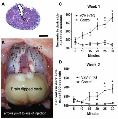 Role for the Ventral Posterior Medial/Posterior Lateral Thalamus and Anterior Cingulate Cortex in Affective/Motivation Pain Induced by Varicella Zoster Virus